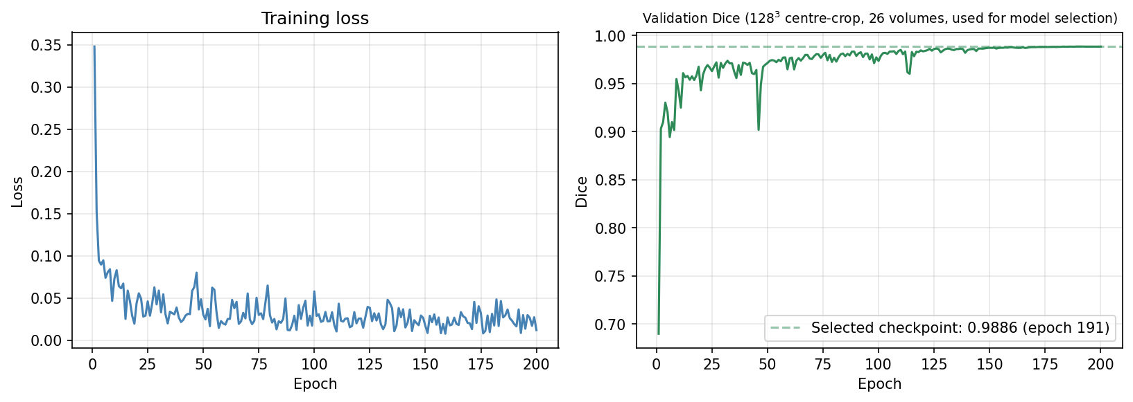 Training loss and validation Dice curves over 200 epochs, showing Dice rising to 0.9886